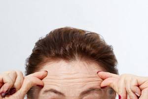 50783760 - How to remove wrinkles on the forehead