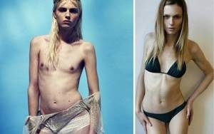 Андрей Пежич до и после операции по смене пола. Фото в молодости и сейчас, история перевоплощения