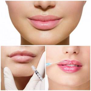 How to enlarge lips