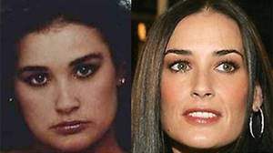 Деми Мур – фото до и после пластики носа