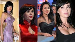Фото до и после пластики звезд российских, зарубежных, Голливуда, шоу-бизнеса, эстрады. Удачные и неудачные операции