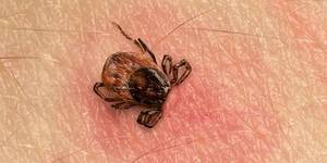 Why do you dream about ticks on your body?