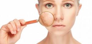Как выровнять тон лица дома и в салоне: выравниваем тон кожи лица