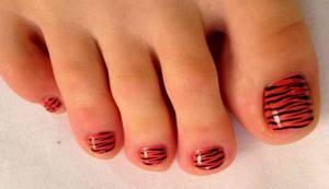 red pedicure with stripes