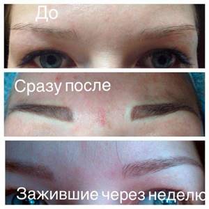 Permanent eyebrow makeup before and after healing
