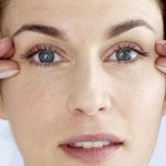 Why do wrinkles appear under the eyes?