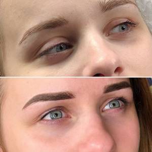 Detailed algorithm for eyebrow care after tattooing in the first seven days