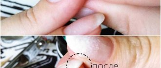 Benefits of acrylic nail strengthening