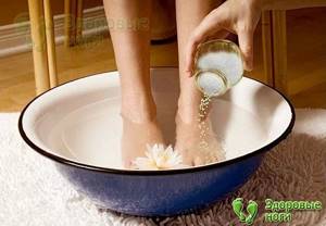 При пяточной шпоре ванночки для ног с солью помогут снять боль и снизить воспаление