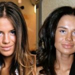 Russian stars before and after plastic surgery