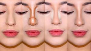 Girls have a wide nose. What to do, how to get rid of it, rhinoplasty 