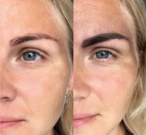 How long does microblading photo last after a year?