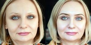 eyebrow tattoo spraying before and after photos