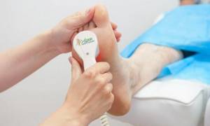 Removal of callus in medical pedicure