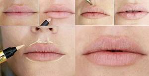 lip augmentation at home