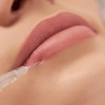 Увеличение губ: способы, виды инъекций, побочные эффекты