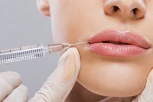 Introduction of fillers